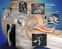 Исследование магнитно-резонансной томографией